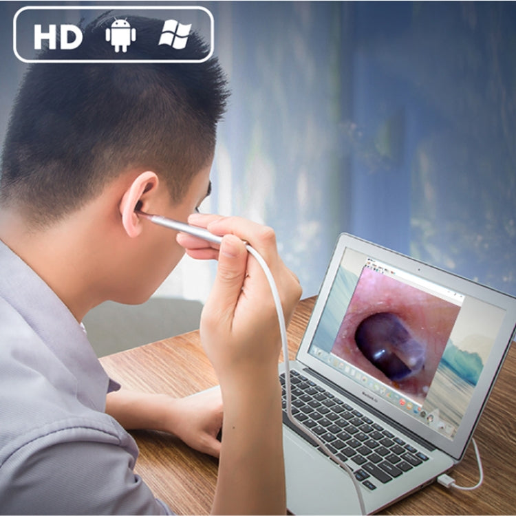 Endoscopio HD 1 MP per denti naso orecchio con 6 LED