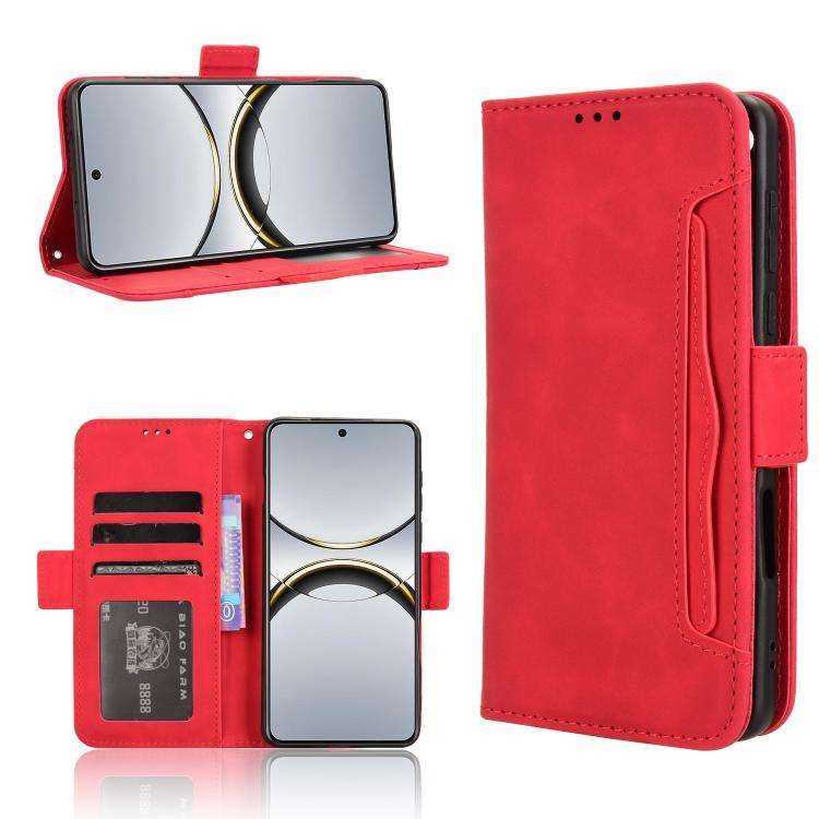 Custodia per telefono in pelle con slot per schede di consistenza al polpaccio, For OPPO A78 4G, For OPPO Find X8 Pro, For OPPO Reno7 A