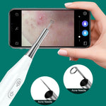 Endoscopio Supereyes Y009 con specchio e ingrandimento