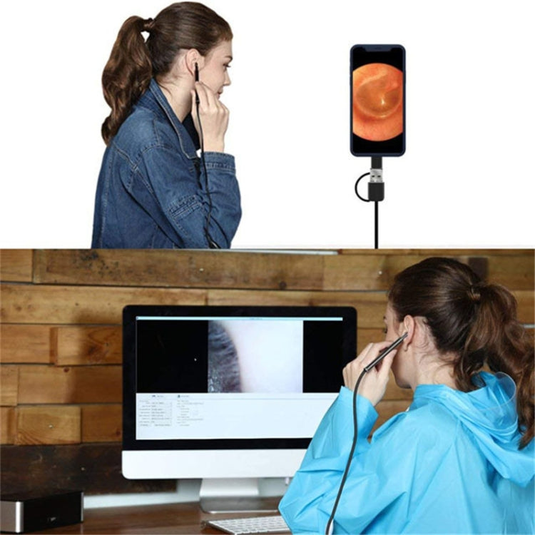 Otoscopio digitale USB HD 3 in 1 con cavo 2 metri