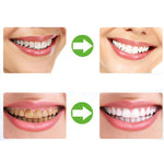 2 pezzi vassoi termoformatura paradenti dentale