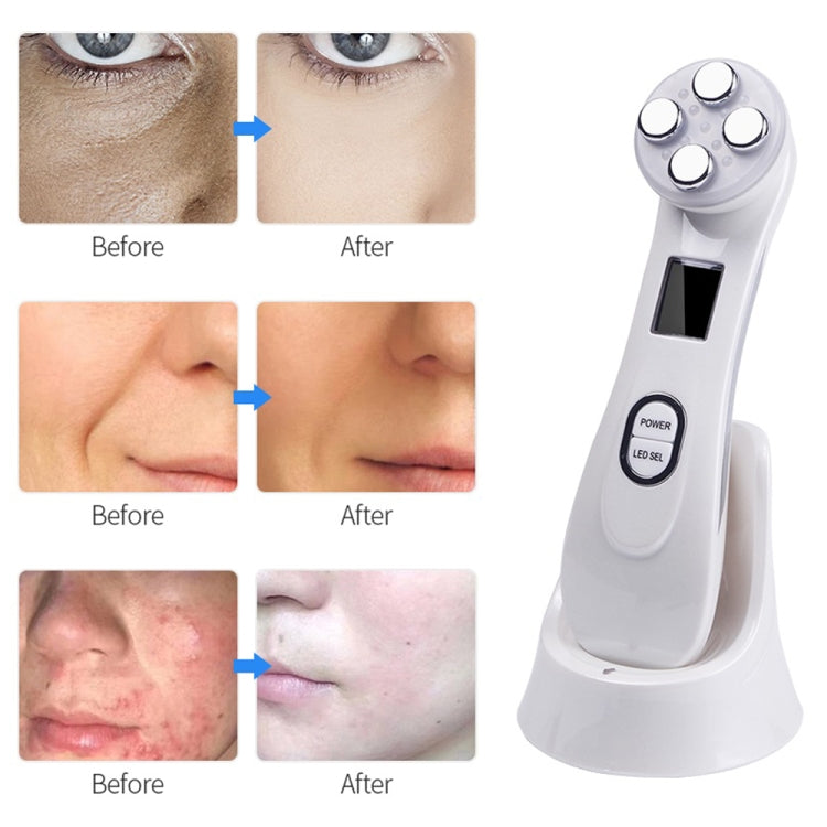 Penna viso a radiofrequenza con LED Photon, EMS e ioni galvanici - immagine 11