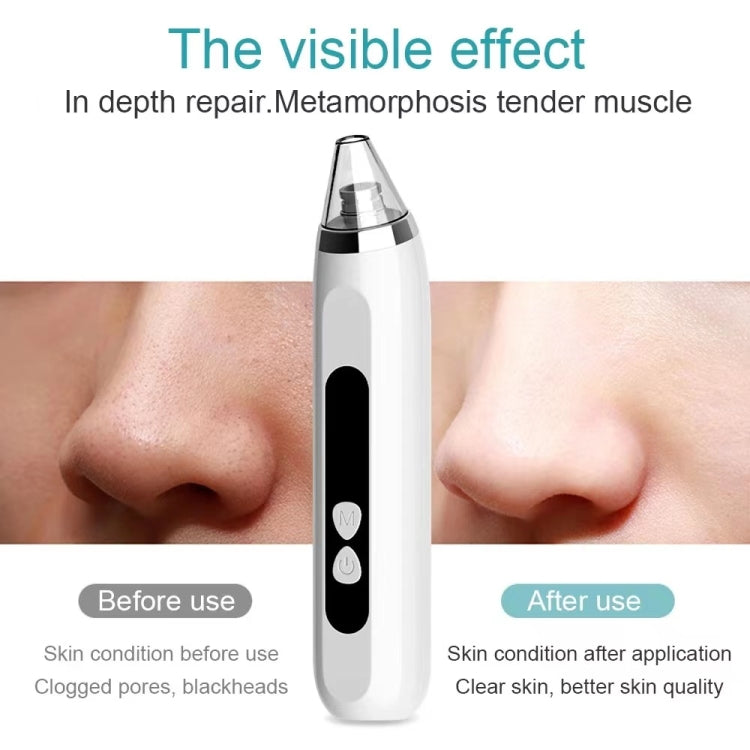 Aspiratore viso per punti neri con 3 livelli e testine - immagine 7