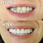 5pcs Copertura per Denti Finti in Silicone Comfort Fit
