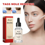 Liquido anti talpa e verruca 30 ml per macchie scure