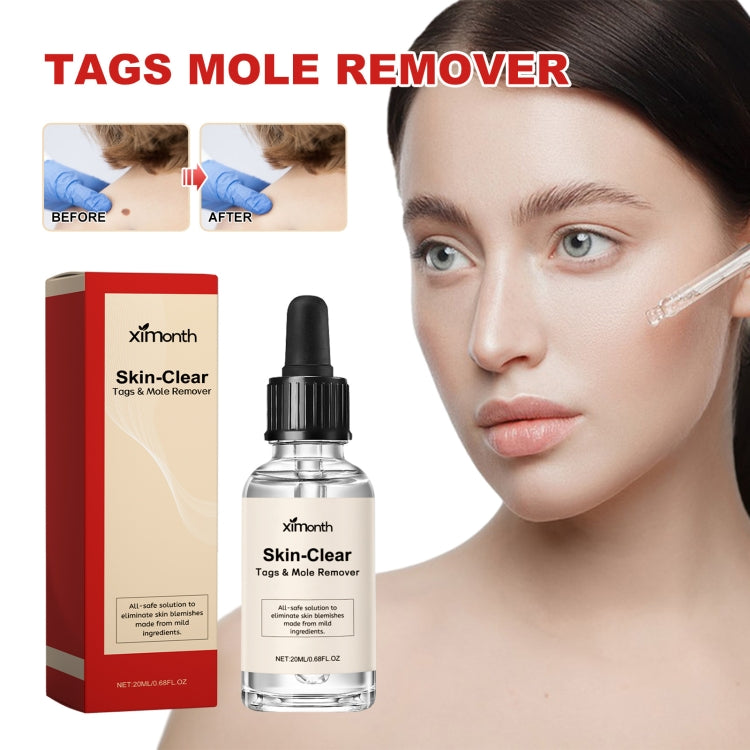 Liquido anti talpa e verruca 30 ml per macchie scure