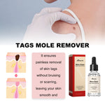 Liquido anti talpa e verruca 30 ml per macchie scure