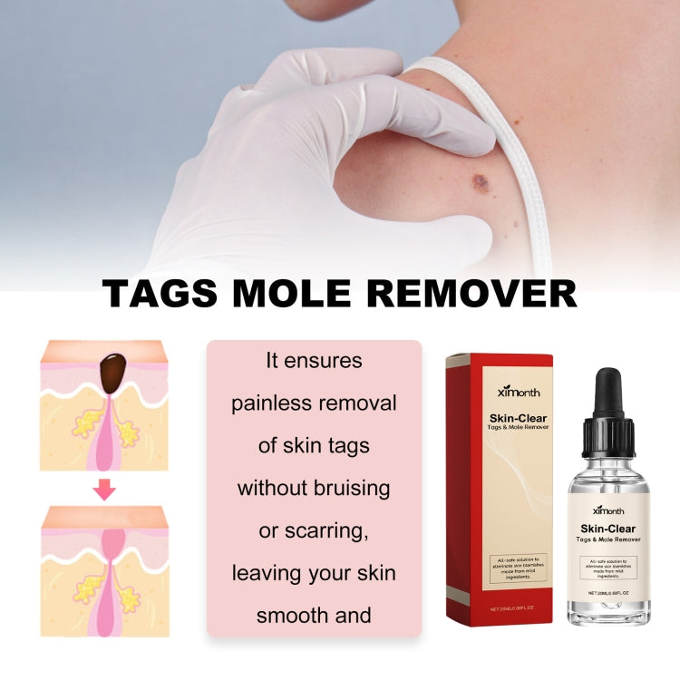 Liquido anti talpa e verruca 30 ml per macchie scure