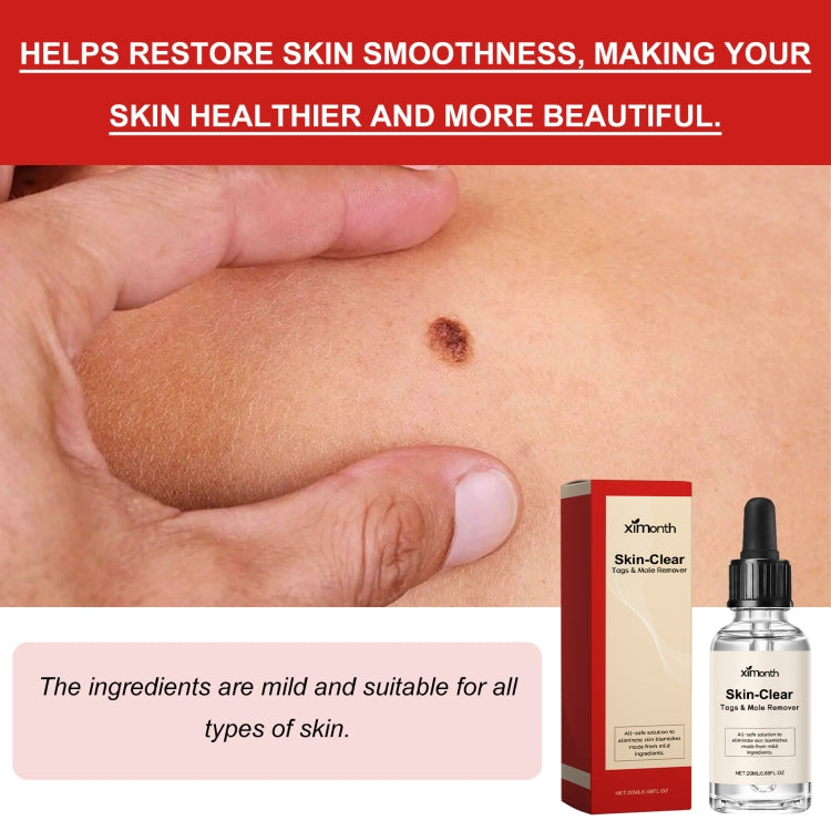 Liquido anti talpa e verruca 30 ml per macchie scure