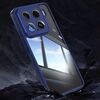 Per Xiaomi 15 Custodia antiurto in TPU ibrida acrilica per telefono (blu)