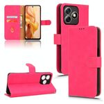 Custodia per telefono in pelle con vibrazione magnetica Ultra Skin Feel per Ulefone Note 18 (rosa rosso)