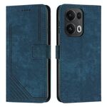 Per OPPO Reno13 Pro Custodia per telefono in pelle con motivo a strisce Global Skin Feel con cordino lungo (blu)