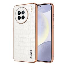 Per vivo X90 / X90s AZNS Custodia per telefono con struttura in coccodrillo elettrolitico a copertura totale (bianca)
