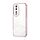 Per Honor 80 Custodia per telefono con foro sottile con placcatura trasparente (rosa) Per Honor 80 Custodia per telefono con foro sottile con placcatura trasparente (rosa)